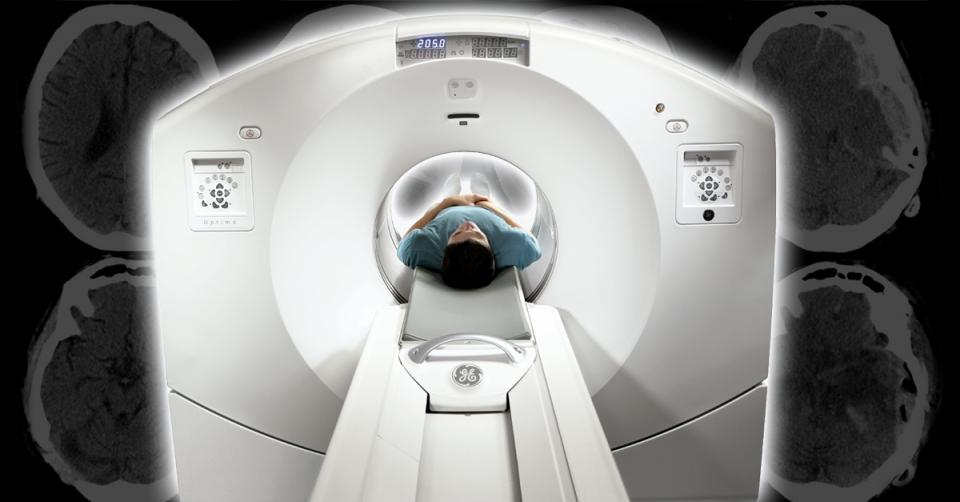 CT scan quadruples brain tumour risk image 