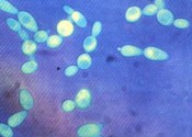Da lievito di birra scoperti 3 geni causa di malattie neurodegenerative