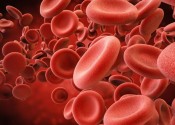 Scoperto gene chiave della Leucemia Mieloide Acuta Individuato utilizzando la tecnica delle forbici genetiche 